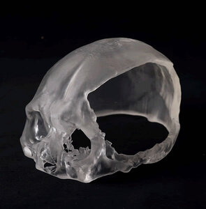 Medical Model Manufacture by Commission (Optical Shaping and Human Skull)